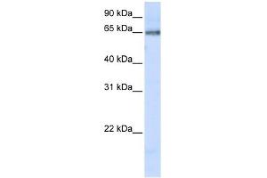 DCLRE1C antibody used at 1 ug/ml to detect target protein. (DCLRE1C anticorps)