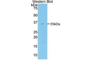 Western Blotting (WB) image for anti-Ectonucleotide Pyrophosphatase/phosphodiesterase 2 (ENPP2) (AA 637-905) antibody (ABIN1858722) (ENPP2 anticorps  (AA 637-905))