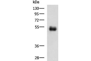 Western blot analysis of Human colorectal cancer tissue lysate using METTL17 Polyclonal Antibody at dilution of 1:700 (METTL17 anticorps)
