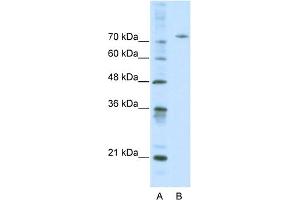 WB Suggested Anti-AFM Antibody Titration:  0. (Afamin anticorps  (Middle Region))
