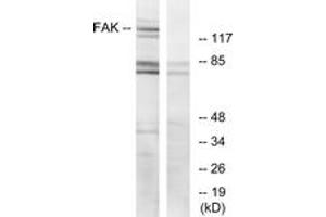 Western blot analysis of extracts from HeLa cells, treated with EGF, using FAK (Ab-925) Antibody. (FAK anticorps  (AA 892-941))