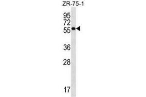 NR1D2 Antibody (Center) western blot analysis in ZR-75-1 cell line lysates (35µg/lane). (NR1D2 anticorps  (Middle Region))