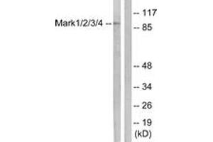 Western blot analysis of extracts from COS7 cells, using MARK1/2/3/4 (Ab-215) Antibody.