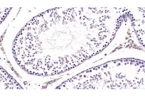 Detection of COL3a1 in Rat Testis Tissue using Monoclonal Antibody to Collagen Type III Alpha 1 (COL3a1)