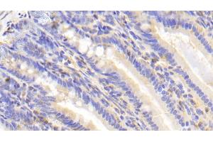 Detection of CEACAM1 in Mouse Colon Tissue using Polyclonal Antibody to Carcinoembryonic Antigen Related Cell Adhesion Molecule 1 (CEACAM1)