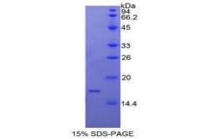 SDS-PAGE of Protein Standard from the Kit (Highly purified E. (Caspase 9 Kit ELISA)