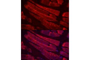 Immunofluorescence analysis of rat skeletal muscle cells using MYH4 Rabbit pAb (ABIN7268749) at dilution of 1:100 (40x lens). (MYH4 anticorps  (AA 1450-1550))