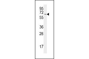 The anti-UBA2 C-term  Antibody (ABIN387913 and ABIN2844315) is used in Western blot to detect UBA2 in Jurkat lysate. (UBA2 anticorps  (C-Term))