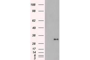 HEK293T cells were transfected with the pCMV6-ENTRY control (Left lane) or pCMV6-ENTRY Noggin (RC205020) (Right lane) cDNA for 48 hrs and lysed. (NOG anticorps  (AA 28-232))