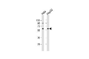 All lanes : Anti-NRT1 Antibody (N-term) at 1:1000 dilution Lane 1: Hela whole cell lysate Lane 2: HepG2 whole cell lysate Lysates/proteins at 20 μg per lane. (NAPRT1 anticorps  (N-Term))