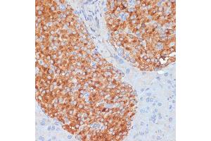 Immunohistochemistry of paraffin-embedded mouse pancreas using RIPK3 antibody (ABIN6132598, ABIN6146964, ABIN6146967 and ABIN6221084) at dilution of 1:100 (40x lens).