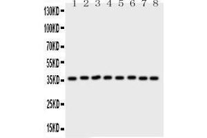 Western Blotting (WB) image for anti-Annexin A5 (ANXA5) (AA 2-320) antibody (ABIN3043502) (Annexin V anticorps  (AA 2-320))