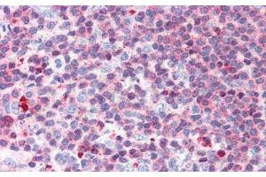 Detection of LTb in Human Spleen Tissue using Polyclonal Antibody to Lymphotoxin Beta (LTb)