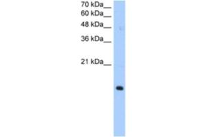 Western Blotting (WB) image for anti-Paired Immunoglobin-Like Type 2 Receptor alpha (PILRA) antibody (ABIN2463032)