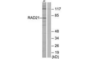 Western blot analysis of extracts from Jurkat cells, using RAD21 Antibody. (RAD21 anticorps  (AA 521-570))