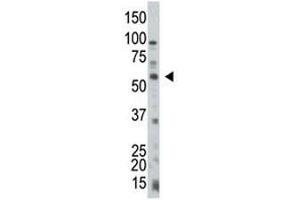 PTEN antibody used in western blot to detect PTEN in HL-60 cell lysate