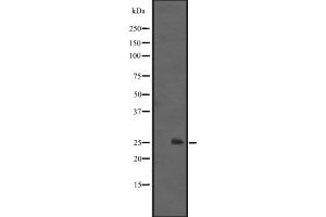 Western blot analysis of IL1F6 expression in HEK293 cells ,The lane on the left is treated with the antigen-specific peptide. (IL36A/IL1F6 anticorps  (Internal Region))