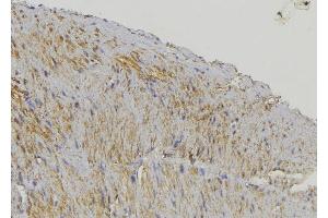 ABIN6274634 at 1/100 staining Mouse muscle tissue by IHC-P.