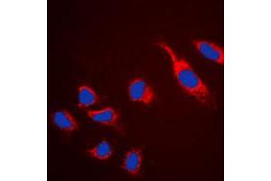 Immunofluorescent analysis of Claudin 5 staining in HeLa cells. (Claudin 5 anticorps  (C-Term))