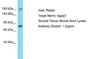 Host: Rabbit Target Name: IQGAP2 Sample Tissue: Mouse Brain Antibody Dilution: 1ug/ml (IQGAP2 anticorps  (C-Term))