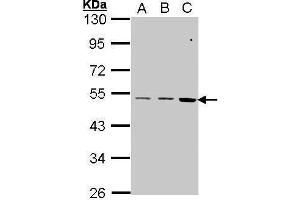 WB Image Sample (30 ug of whole cell lysate) A: A431 , B: H1299 C: Hela 10% SDS PAGE antibody diluted at 1:1000 (CCKBR anticorps  (C-Term))