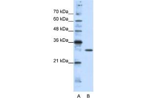 WB Suggested Anti-GSCL Antibody Titration:  1. (GSC2 anticorps  (C-Term))
