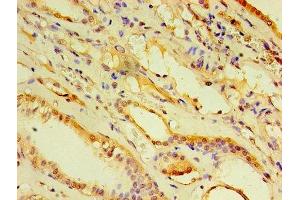 Immunohistochemistry of paraffin-embedded human kidney tissue using ABIN7143455 at dilution of 1:100 (ARF6 anticorps  (AA 1-175))