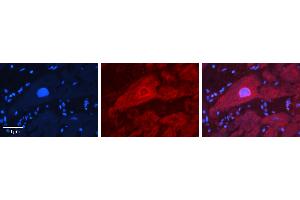 Rabbit Anti-IRF6 Antibody   Formalin Fixed Paraffin Embedded Tissue: Human heart Tissue Observed Staining: Cytoplasmic, nucleus Primary Antibody Concentration: N/A Other Working Concentrations: 1:600 Secondary Antibody: Donkey anti-Rabbit-Cy3 Secondary Antibody Concentration: 1:200 Magnification: 20X Exposure Time: 0. (IRF6 anticorps  (Middle Region))