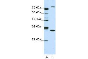 WB Suggested Anti-EXOSC2 Antibody Titration:  1.