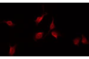 ABIN6267608 staining NIH-3T3 by IF/ICC.