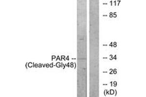 Western blot analysis of extracts from NIH-3T3 cells, treated with etoposide 25uM 1h, using PAR4 (Cleaved-Gly48) Antibody. (F2RL3 anticorps  (Cleaved-Gly48))