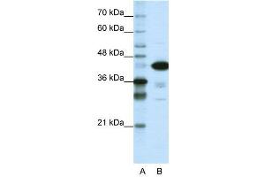 WB Suggested Anti-TARDBP  Antibody Titration: 1. (TARDBP anticorps  (N-Term))