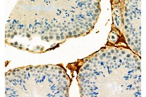 ABIN6265680 and ABIN6278645 at 1/100 staining Mouse testis tissue by IHC-P. (TP53INP1 anticorps  (Internal Region))