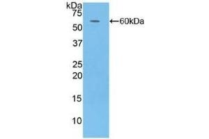 Detection of Recombinant CFD, Human using Polyclonal Antibody to Complement Factor D (CFD) (Adipsin anticorps  (AA 1-253))