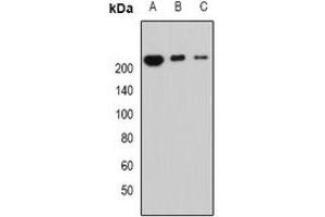 Western blot analysis of Periplakin expression in MCF7 (A), mouse lung (B), mouse heart (C) whole cell lysates. (PPL anticorps)