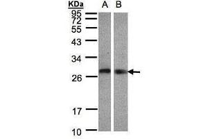 WB Image Sample(30 ug whole cell lysate) A:Hep G2 , B:Raji , 12% SDS PAGE antibody diluted at 1:1000 (LYPLA2 anticorps)