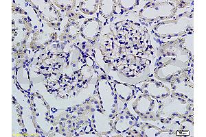 Formalin-fixed and paraffin embedded rat kidney tissue labeled with Rabbit Anti-Podoplanin/gp36 Polyclonal Antibody (ABIN736896), Unconjugated 1:200 followed by conjugation to the secondary antibody and DAB staining (Podoplanin anticorps  (AA 91-166))