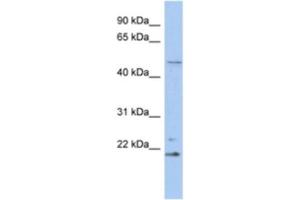 Western Blotting (WB) image for anti-Retinoblastoma Binding Protein 9 (RBBP9) antibody (ABIN2463903) (RBBP9 anticorps)