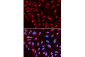 Immunofluorescence analysis of U2OS cell using CTBP1 antibody. (CTBP1 anticorps  (AA 20-250))
