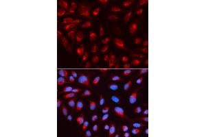 Immunofluorescence analysis of U2OS cell using CTBP1 antibody. (CTBP1 anticorps  (AA 20-250))