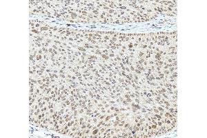 anti-RNA polymerase-associated protein RTF1 homolog (RTF1) (AA 77-705) antibody