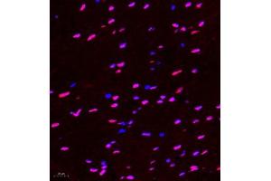 Immunofluorescence of paraffin embedded rat spinal cord using Hes2 (ABIN7074158) at dilution of 1:100 (400x lens)