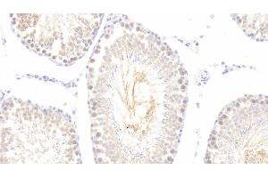 Detection of SNCa in Rat Testis Tissue using Polyclonal Antibody to Synuclein Alpha (SNCa)