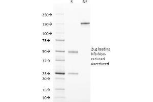 SDS-PAGE Analysis Purified TCL1 Mouse Monoclonal Antibody (TCL1/2078). (TCL1A anticorps  (AA 2-109))