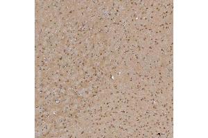 IHC analysis of Sm-D3/SNRPD3 using anti-Sm-D3/SNRPD3 antibody (ABIN7598952).