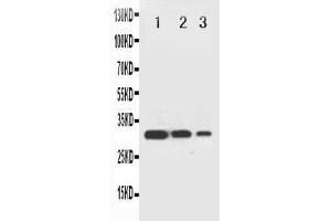 Western Blotting (WB) image for anti-TNF Receptor-Associated Factor 2 (TRAF2) (AA 305-325), (Middle Region) antibody (ABIN3044047)