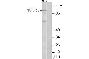 Western blot analysis of extracts from K562 cells, using NOC3L antibody. (NOC3L anticorps  (Internal Region))