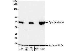Western Blotting (WB) image for anti-Keratin 14 (KRT14) (C-Term) antibody (ABIN7795698) (Recombinant KRT14 anticorps  (C-Term))