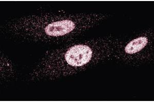 Immunofluorescence staining of human fibroblasts. (MSH3 anticorps  (AA 136-349))