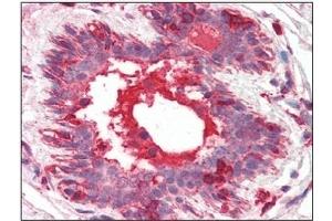 Immunohistochemistry (IHC) image for anti-Hepatocyte Growth Factor (Hepapoietin A, Scatter Factor) (HGF) antibody (ABIN492557) (HGF anticorps)